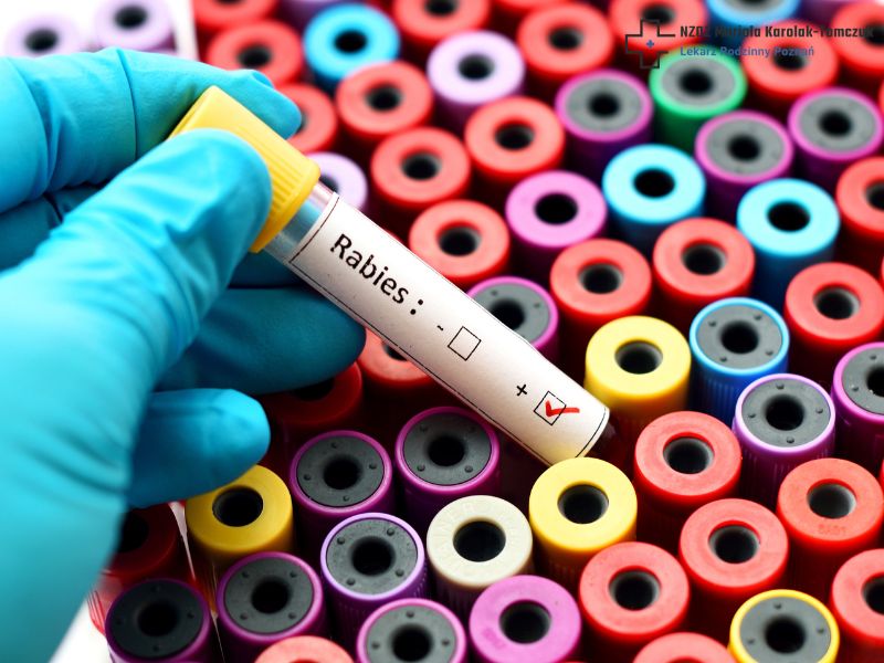 What is Rabies in Humans?