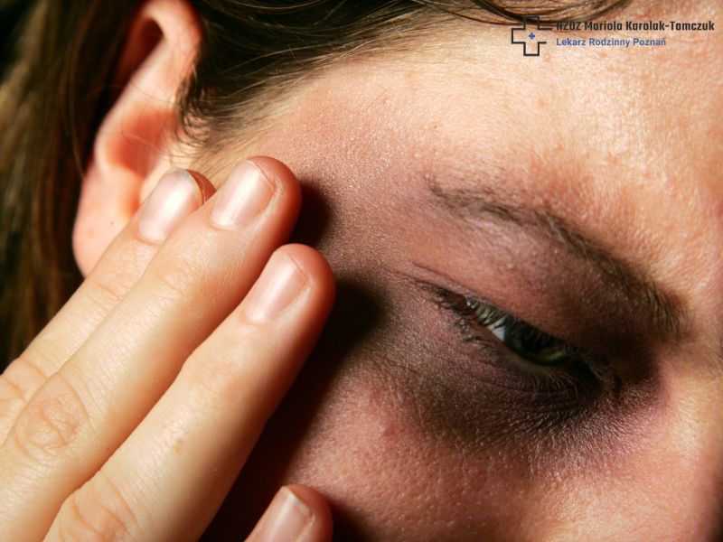 Are Dark Circles Under the Eyes a Symptom of a Disease?